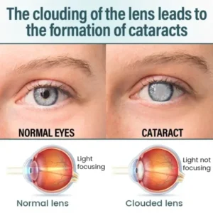 Piguiay® OptiFusion Nano Eye Drops Serum