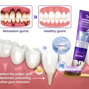 SEAGRIL® BeeRenew Advanced Gum Healing Toothpaste