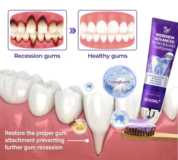 SEAGRIL® BeeRenew Advanced Gum Healing Toothpaste