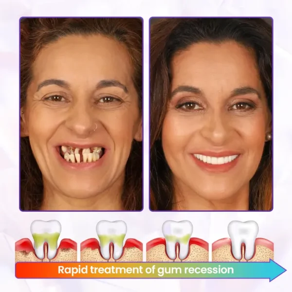 SEAGRIL® BeeRenew Advanced Gum Healing Toothpaste