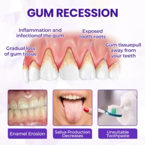 SEAGRIL® BeeRenew Advanced Gum Healing Toothpaste