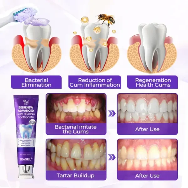 SEAGRIL® BeeRenew Advanced Gum Healing Toothpaste