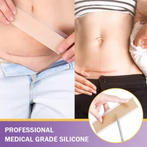 ✅Official Store |SEAGRIL® Hyaluronic Acid Nano Microneedle Repair Tape🏥(Treatment of old and new scars, reduction of surgical scars, stretch marks, keloids, acne, burns, warts, dermatomes and varicose veins)