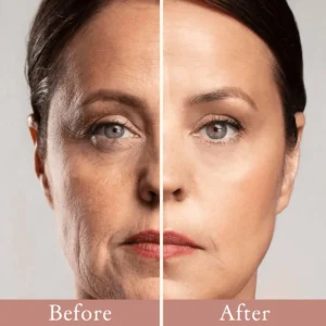 SEAGRIL Eye Roller for Puffiness | Removes 97% of under-eye bags in 60 seconds