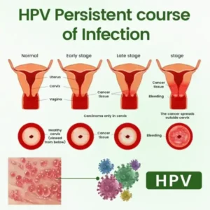 Timilk® FeminaDefend All-In-One Intimate Therapy Pads