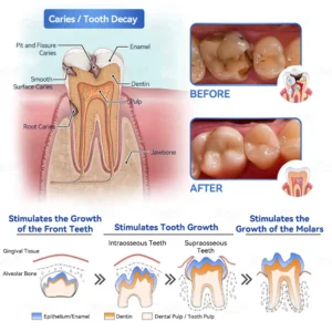 𝑃𝑖𝑐𝑑𝑜®🍁💖 𝑆𝑡𝑒𝑚 𝐶𝑒𝑙𝑙 𝐺𝑖𝑛𝑔𝑖𝑣𝑎𝑙 𝑅𝑒𝑝𝑎𝑖𝑟 𝑀𝑜𝑢𝑠𝑠𝑒(🦷Promote Tooth Regrowth • Remove Tartar • Strengthen Gums • Deep Clean & Freshen Breath)