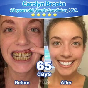 𝑃𝑖𝑐𝑑𝑜®🍁💖 𝑆𝑡𝑒𝑚 𝐶𝑒𝑙𝑙 𝐺𝑖𝑛𝑔𝑖𝑣𝑎𝑙 𝑅𝑒𝑝𝑎𝑖𝑟 𝑀𝑜𝑢𝑠𝑠𝑒(🦷Promote Tooth Regrowth • Remove Tartar • Strengthen Gums • Deep Clean & Freshen Breath)