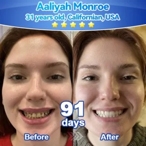 𝑃𝑖𝑐𝑑𝑜®🍁💖 𝑆𝑡𝑒𝑚 𝐶𝑒𝑙𝑙 𝐺𝑖𝑛𝑔𝑖𝑣𝑎𝑙 𝑅𝑒𝑝𝑎𝑖𝑟 𝑀𝑜𝑢𝑠𝑠𝑒(🦷Promote Tooth Regrowth • Remove Tartar • Strengthen Gums • Deep Clean & Freshen Breath)