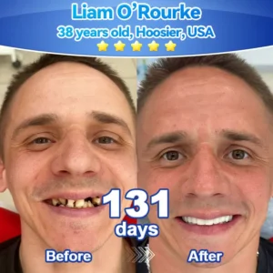 𝑃𝑖𝑐𝑑𝑜®🍁💖 𝑆𝑡𝑒𝑚 𝐶𝑒𝑙𝑙 𝐺𝑖𝑛𝑔𝑖𝑣𝑎𝑙 𝑅𝑒𝑝𝑎𝑖𝑟 𝑀𝑜𝑢𝑠𝑠𝑒(🦷Promote Tooth Regrowth • Remove Tartar • Strengthen Gums • Deep Clean & Freshen Breath)