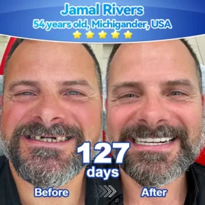 𝑃𝑖𝑐𝑑𝑜®🍁💖 𝑆𝑡𝑒𝑚 𝐶𝑒𝑙𝑙 𝐺𝑖𝑛𝑔𝑖𝑣𝑎𝑙 𝑅𝑒𝑝𝑎𝑖𝑟 𝑀𝑜𝑢𝑠𝑠𝑒(🦷Promote Tooth Regrowth • Remove Tartar • Strengthen Gums • Deep Clean & Freshen Breath)