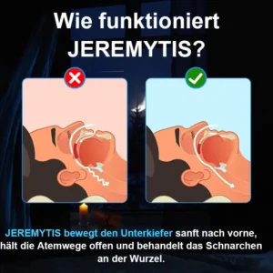 JEREMYTIS™ Verstellbares Anti-Schnarch-Mundstück