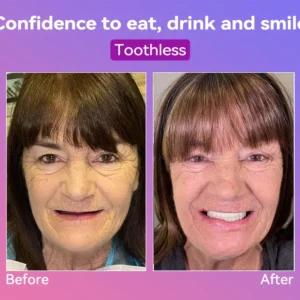 𝐉𝐚𝐬𝐬𝐞𝐞𝐦® Latest Premium Comfort Dentures