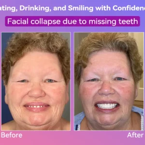 𝐉𝐚𝐬𝐬𝐞𝐞𝐦® Latest Premium Comfort Dentures