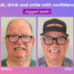 𝐉𝐚𝐬𝐬𝐞𝐞𝐦® Latest Premium Comfort Dentures