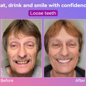 𝐉𝐚𝐬𝐬𝐞𝐞𝐦® Latest Premium Comfort Dentures