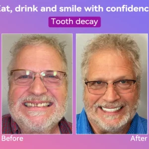 𝐉𝐚𝐬𝐬𝐞𝐞𝐦® Latest Premium Comfort Dentures