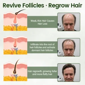 Lovilds® Hair Restoration Spray