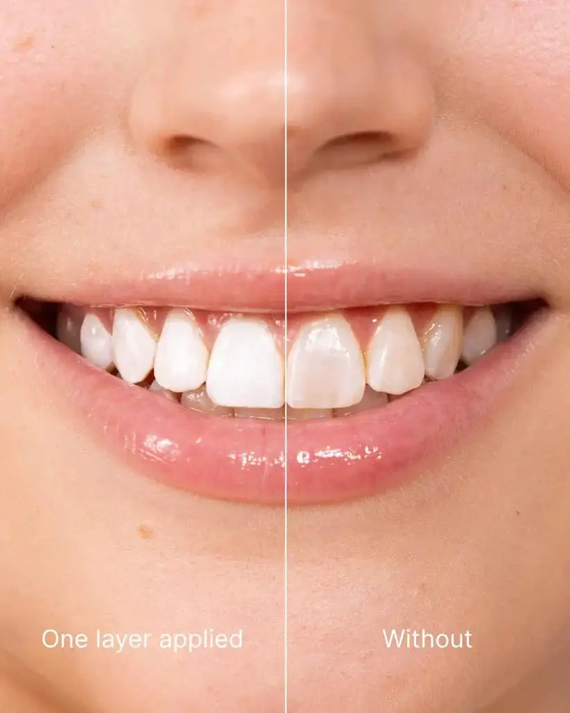 Misspone™ Tooth Polish - Instant Clean Smile