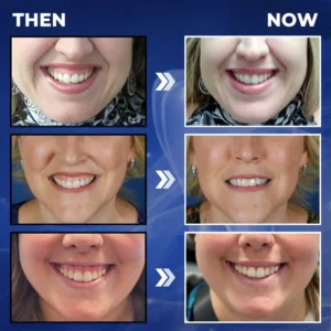 Newyou® Bee Venom Dental Treatment Drops Mouthwash