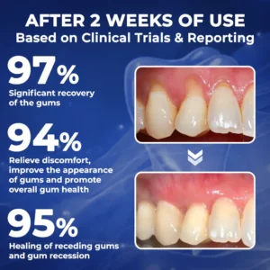 Newyou® Bee Venom Dental Treatment Drops Mouthwash