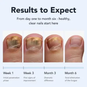 Nuvira™ Antifungal Pen