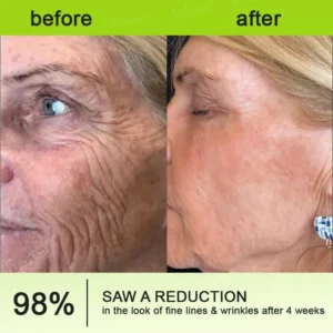 Rolimey® Botox & Vita-A Retinol Shot Wrinkle-Lift Tightening cream