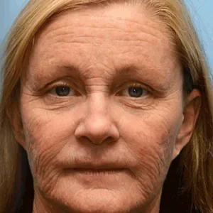 Rolimey® Botox & Vita-A Retinol Shot Wrinkle-Lift Tightening cream