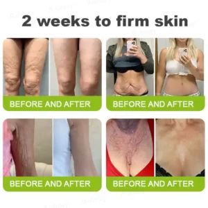 Rolimey® Botox & Vita-A Retinol Shot Wrinkle-Lift Tightening cream