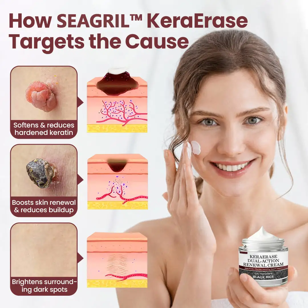 SEAGRIL™KeraErase Dual-Action Renewal Cream