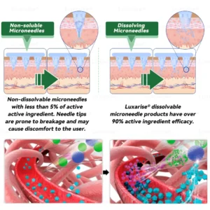 𝑳𝒖𝒙𝒂𝒓𝒊𝒔𝒆® 𝑺𝒕𝒆𝒎 𝑪𝒆𝒍𝒍 𝑩𝒆𝒓𝒃𝒆𝒓𝒊𝒏𝒆 10-𝑰𝑵-1 𝑨𝒅𝒗𝒂𝒏𝒄𝒆𝒅 𝑵𝒂𝒏𝒐 𝑴𝒊𝒄𝒓𝒐𝒏𝒆𝒆𝒅𝒍𝒆 𝑷𝒂𝒕𝒄𝒉