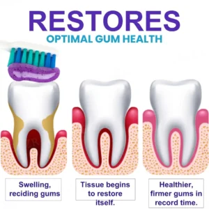 AEXZR® Apisphere Dental Repair Toothpaste