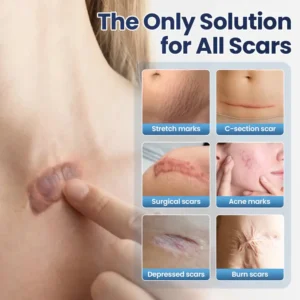 CLINCLII® Texture Repair Gel