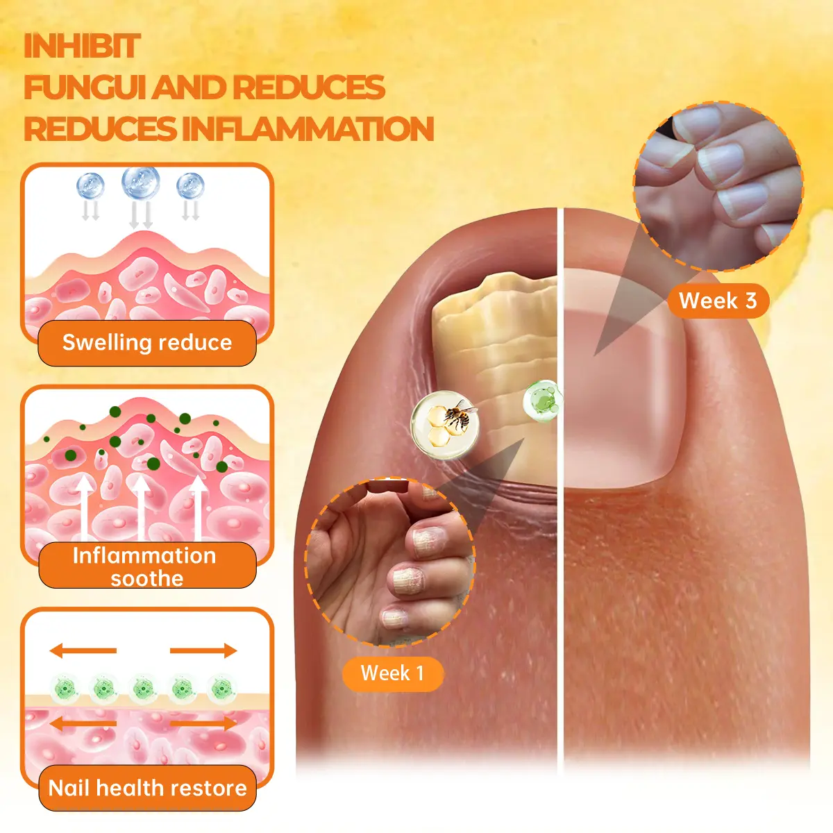 Cvreoz® Nail Renewal Spray