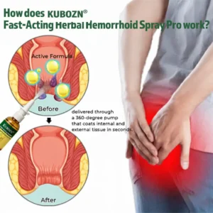 KUBOZN® Fast-Acting Herbal Hemorrhoid Spray Pro