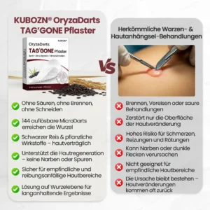 KUBOZN® OryzaDarts TAG’GONE – Schmerzfreie Entfernung an der Wurzel dank Schwarzer-Reis-Mikrotechnologie ✨