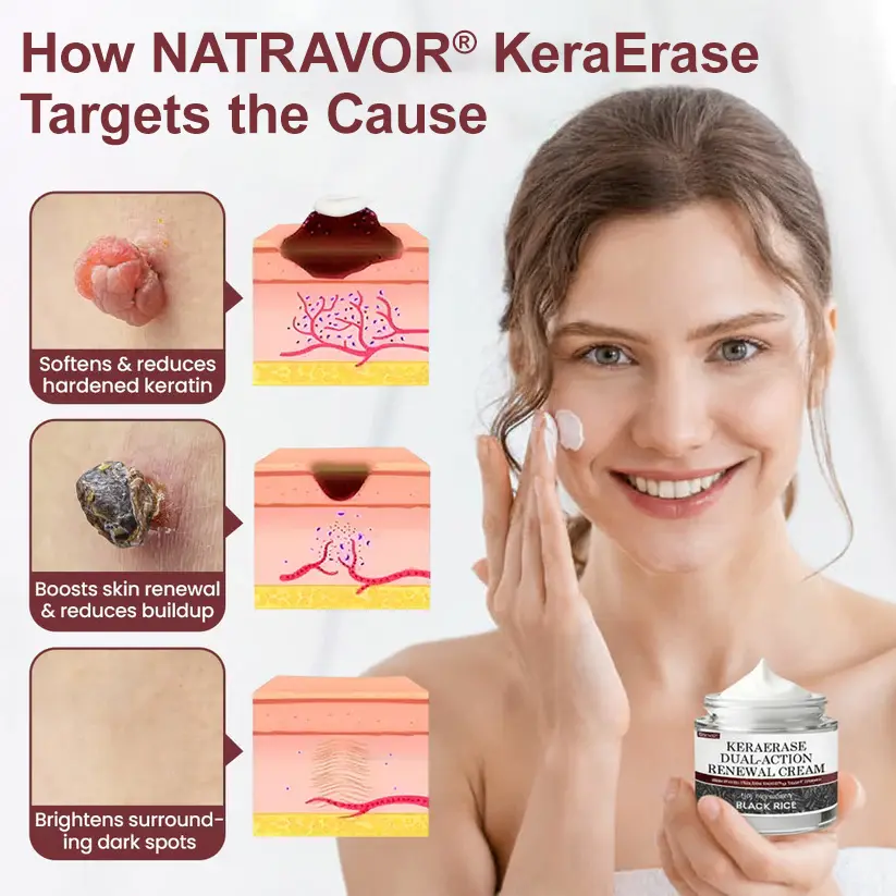 NATRAVOR® KeraErase Dual-Action Renewal Cream