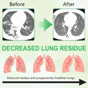 ODEIUN® 3X Concentrated Mullein Lung Cleanse Spray