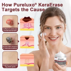 Pureluxo® KeraErase Dual-Effect Renewal Cream