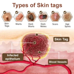 Pureluxo® KeraErase Dual-Effect Renewal Cream