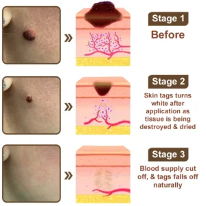 Pureluxo® KeraErase Dual-Effect Renewal Cream