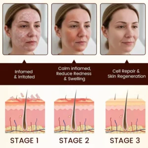 QIAWI Bee Venom Multi-Symptom Treatment Cream