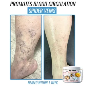 QIAWI Bee Venom Multi-Symptom Treatment Cream