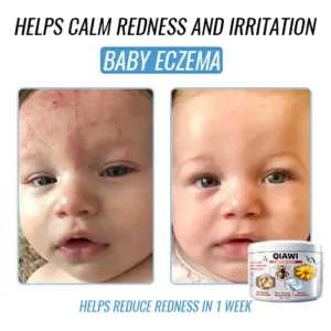 QIAWI Bee Venom Multi-Symptom Treatment Cream