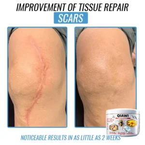 QIAWI Bee Venom Multi-Symptom Treatment Cream