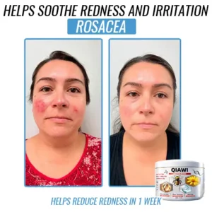 QIAWI Bee Venom Multi-Symptom Treatment Cream