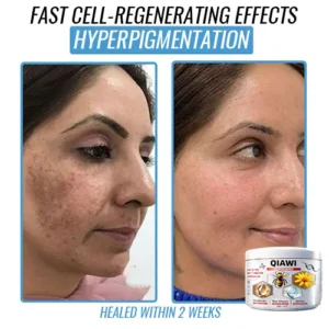 QIAWI Bee Venom Multi-Symptom Treatment Cream