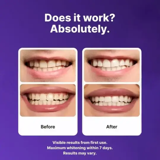 QIAWI Purple Whitening Strips