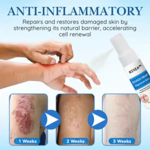 RZXEA™ Source-Relief Magnesium Spray