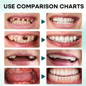 SEAGRIL® FirmHold Denture Adhesive