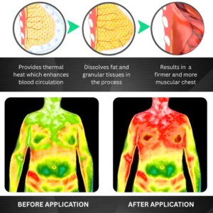 RZXEA™ Gynecomastia 3 in1 Nano Microneedle Patch